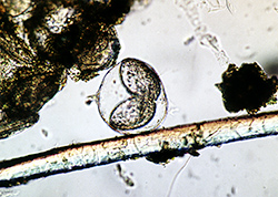 Bachmuschellarve: Glochidium (stark vergrößert)
